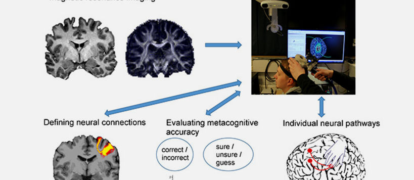 Combining different brain research methods enables taking into account individual differences in the brain anatomy. Picture: Juha Gogulski & Mikko Nyrhinen.