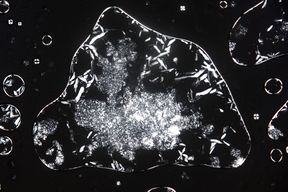 Liquid crystal sample under a polarized optical microscope.