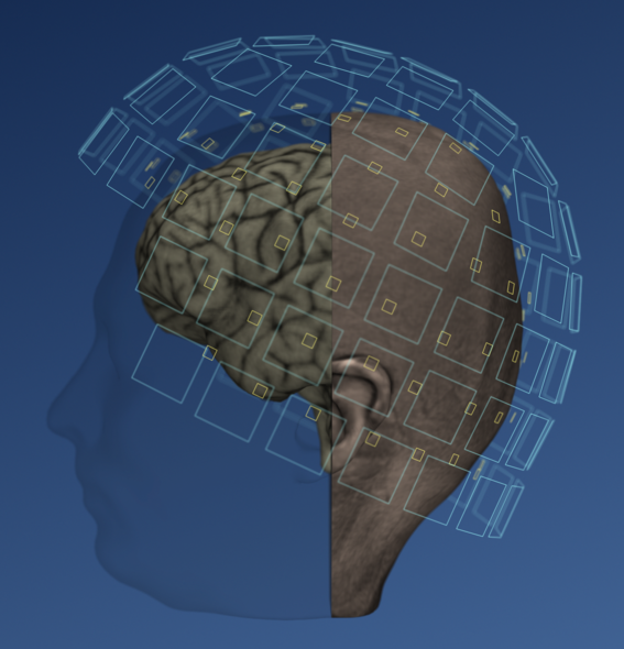 Magneettikenttäantureita aivosignaalien mittaamiseen magnetoenkefalografialla eli MEG:llä.