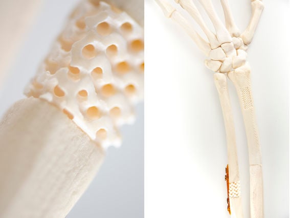 PoTe 3D printed implants for bone regeneration / Photo: Valeria Azovskaya