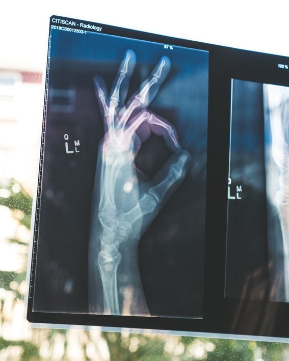 X-ray of hand with fingers making OK sign