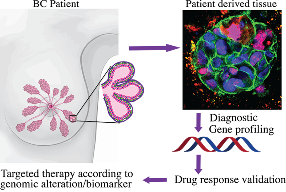 The ability of 3D matrix to maintain the cellular identity and heterogeneity of patient derived cancer tissues allow individualized breast cancer therapy approach. Image: Lahja Martikainen, Pauliina Munne and Nonappa.