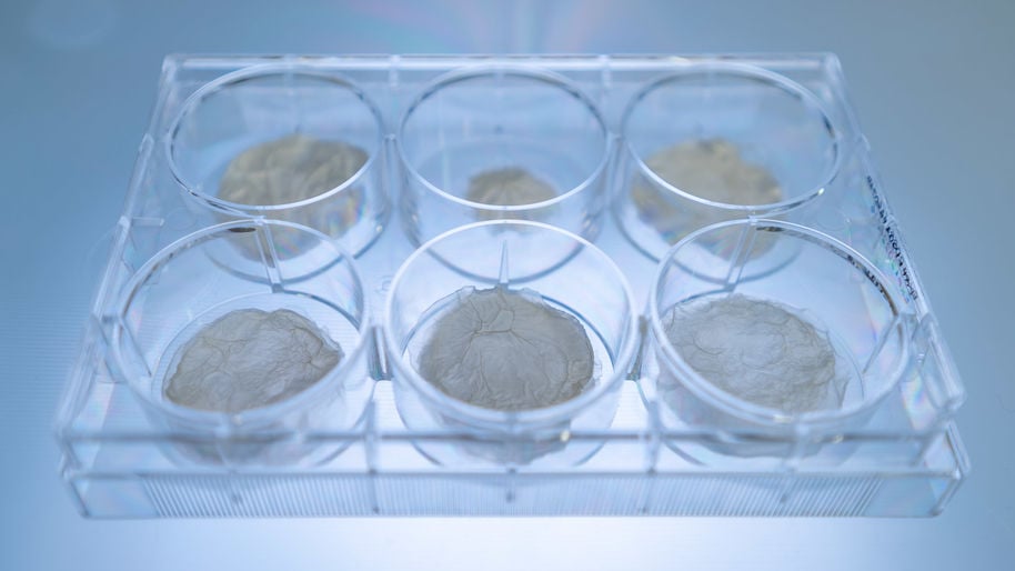 Colour photo of six clear petri dishes containing brown coloured masses of dried bacterial nanocellulose inside a clear rectangular tray