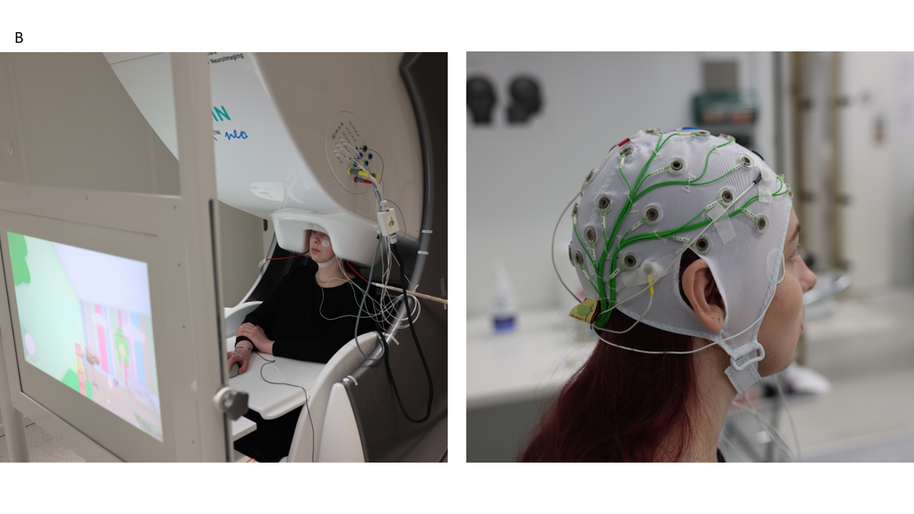 magnetoencephalography setting