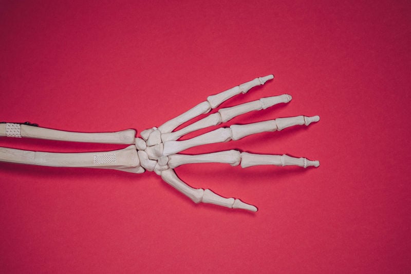 3D arm bone
